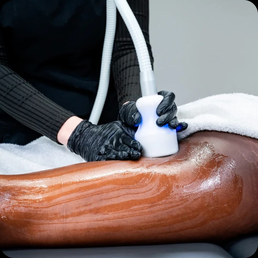 SK Performance body sculpting treatment room with warm lighting and luxury finishes